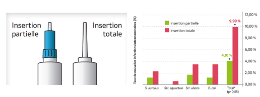 Insertion partielle et totale