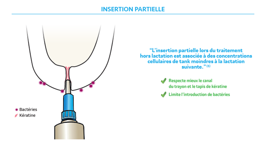 Insertion partielle