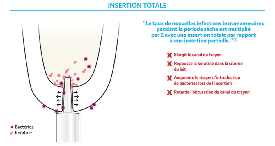 Insertion totale