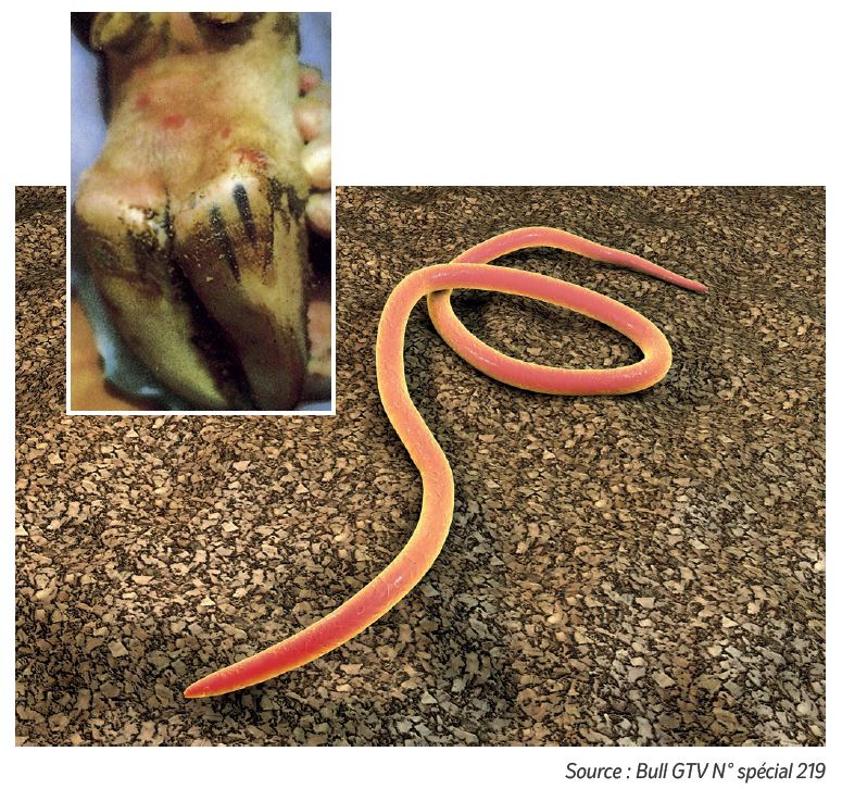 strongyloides